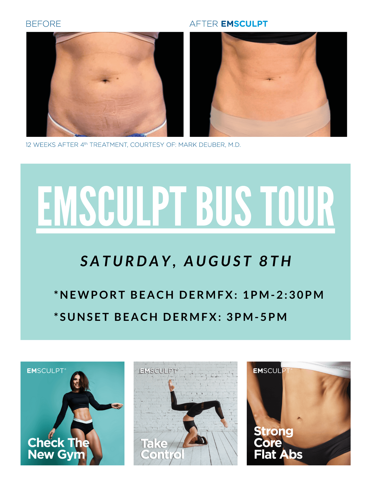 Emsculpt | Body Treatments | Sunset Beach, CA